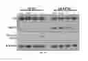 Fig. 28 - Modulators of resistant androgen receptor