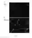 Fig. 13 - Methods of increasing sarcolemmal utrophin