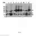 Fig. 16 - METHODS AND PRODUCTS FOR INCREASING FRATAXIN LEVELS AND USES THEREOF