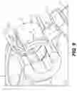 Fig. 08 - Integrated excavator pin grabber quick coupler