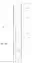 Fig. 18 - Fill up tool