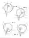 Fig. 09 - Actuating device for actuating a cable