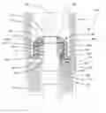 Fig. 01 - Mechanical seal protector for ESP seal sections
