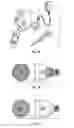 Fig. 02 - LED and/or laser light source or bulb for light device