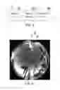 Fig. 06 - Optical imaging device