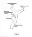 Fig. 11 - BLOOD-VESSEL-SHAPE CONSTRUCTION DEVICE FOR BLOOD-FLOW SIMULATION, METHOD THEREFOR, AND COMPUTER SOFTWARE PROGRAM