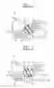 Fig. 02 - Current limiting device of circuit breaker