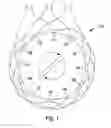 Fig. 02 - Stator for an electric motor or generator