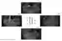 Fig. 01 - Method and apparatus for processing surrounding images of vehicle