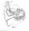 Fig. 02 - Incus short process attachment for implantable float transducer