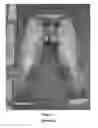 Fig. 02 - Performance garment having a realistic visual effect of abraded denim