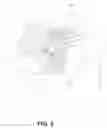 Fig. 04 - Decorative hair accessory, and method of using same