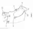 Fig. 08 - Single hand operated collapsing hanger