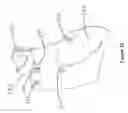 Fig. 29 - Single hand operated collapsing hanger