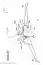 Fig. 82 - Single hand operated collapsing hanger