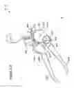 Fig. 84 - Single hand operated collapsing hanger