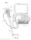 Fig. 02 - Multiple viewing elements endoscope system with modular imaging units