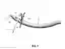Fig. 08 - Method and apparatus for passing suture through tissue
