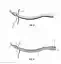Fig. 09 - Method and apparatus for passing suture through tissue