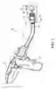 Fig. 02 - Methods of inserting a circular stapling apparatus into a body lumen