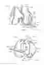 Fig. 08 - PATIENT-SPECIFIC PARTIAL KNEE GUIDES AND OTHER INSTRUMENTS