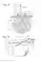 Fig. 08 - Systems and methods for removing a tissue specimen or organ through a small incision or natural opening in a patient