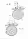 Fig. 09 - Systems and methods for removing a tissue specimen or organ through a small incision or natural opening in a patient
