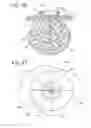 Fig. 12 - Systems and methods for removing a tissue specimen or organ through a small incision or natural opening in a patient