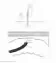 Fig. 01 - Percutaneous Gastrointestinal Access System and Method