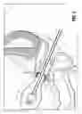Fig. 07 - UTERINE MANIPULATOR