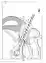 Fig. 09 - UTERINE MANIPULATOR