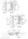 Fig. 08 - Conforming bone stabilization receiver