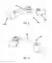 Fig. 02 - MULTIPLE DIAMETER SPINAL ROD CLAMPING MECHANISM