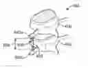 Fig. 01 - METHOD FOR PREVENTING VERTEBRA DISPLACEMENT AFTER SPINAL FUSION SURGERY