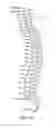 Fig. 02 - METHOD FOR PREVENTING VERTEBRA DISPLACEMENT AFTER SPINAL FUSION SURGERY