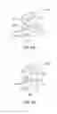 Fig. 09 - METHOD FOR PREVENTING VERTEBRA DISPLACEMENT AFTER SPINAL FUSION SURGERY