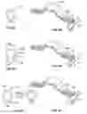 Fig. 07 - Spine protection device