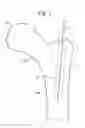 Fig. 02 - Multichannel cannula and methods for using same