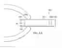 Fig. 22 - Robotic devices and systems for performing single incision procedures and natural orifice translumenal endoscopic surgical procedures, and methods of configuring robotic devices and systems