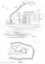 Fig. 02 - Surgical laser systems and laser lithotripsy techniques