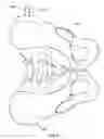 Fig. 07 - PATIENT-SPECIFIC PROSTHESIS ALIGNMENT