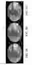 Fig. 06 - System and method for image localization of effecters during a medical procedure