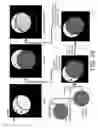 Fig. 35 - System and method for image localization of effecters during a medical procedure