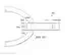 Fig. 15 - Robotic devices and systems for performing single incision procedures and natural orifice translumenal endoscopic surgical procedures, and methods of configuring robotic devices and systems