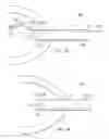 Fig. 18 - Robotic devices and systems for performing single incision procedures and natural orifice translumenal endoscopic surgical procedures, and methods of configuring robotic devices and systems