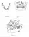 Fig. 02 - METHOD FOR FACILITATING A TOOTH REPOSITIONING DENTAL TREATMENT