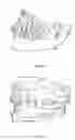 Fig. 03 - METHOD FOR FACILITATING A TOOTH REPOSITIONING DENTAL TREATMENT