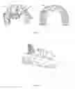 Fig. 04 - METHOD FOR FACILITATING A TOOTH REPOSITIONING DENTAL TREATMENT