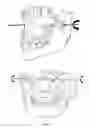Fig. 06 - METHOD FOR FACILITATING A TOOTH REPOSITIONING DENTAL TREATMENT