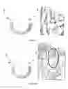 Fig. 07 - METHOD FOR FACILITATING A TOOTH REPOSITIONING DENTAL TREATMENT